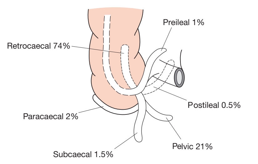Bleeding Per Rectum: Causes, Symptoms, and When to See a Doctor